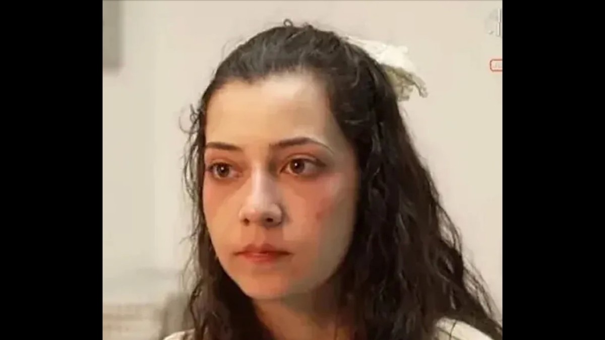 跳樓自殺未遂下身癱瘓 西班牙25歲女子與父打官司勝訴 獲准安樂死