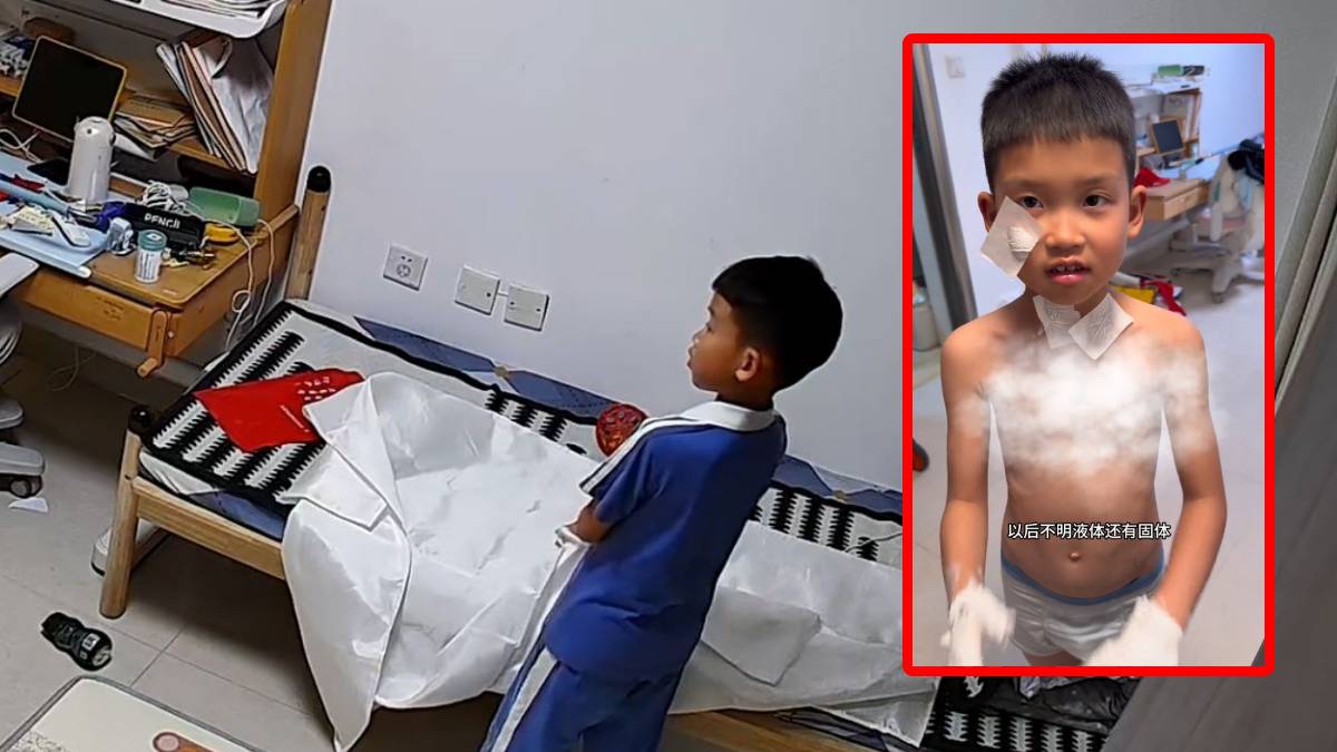 滅火毯︱廣東男童好奇翻看  全身粘玻璃纖維又痕又痛