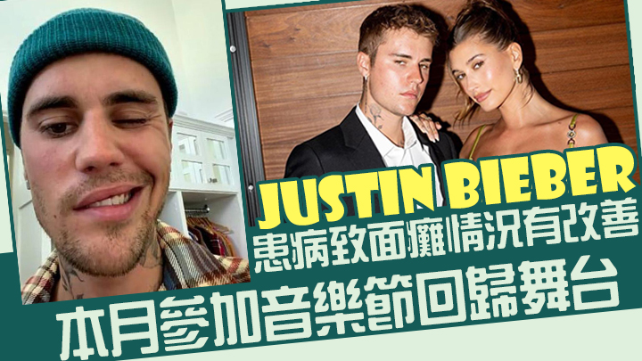 Justin Bieber患病致面癱情況有改善本月參加音樂節回歸舞台