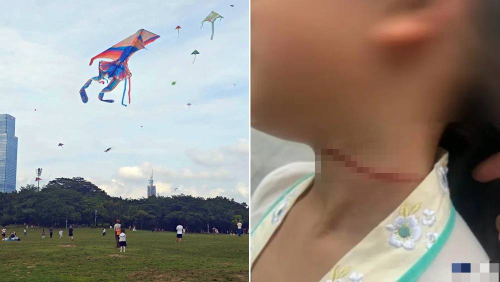 深圳蓮花山公園｜風箏線成「隱形利刃」 7歲女童遭「割喉」留疤