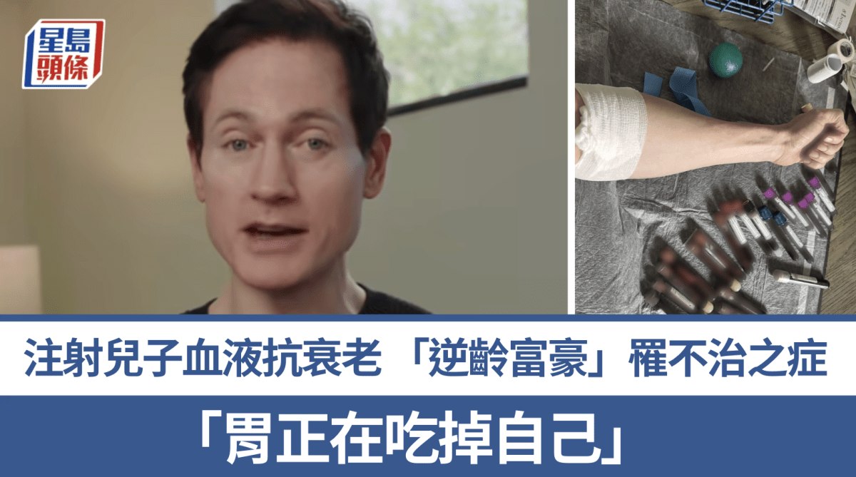 科技富豪年耗千萬抗衰 竟患罕見自體免疫胃炎 免疫系統誤殺健康細胞