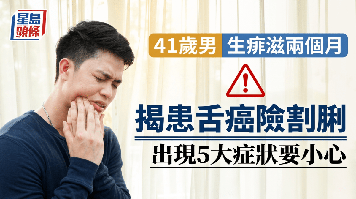41歲男生痱滋兩個月不痛不癢 求醫驚揭患舌癌險割脷 出現5大症狀要小心