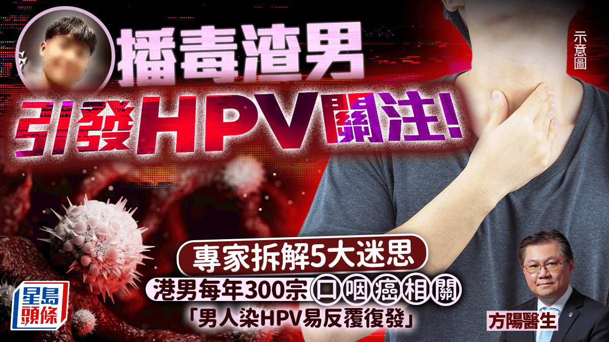 播毒渣男引發HPV關注！專家拆解5大迷思 港男每年300宗口咽癌相關 染病易反覆復發