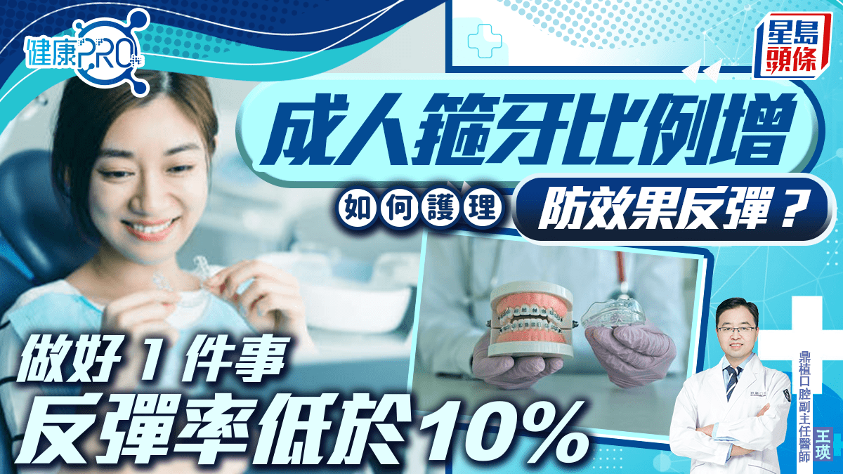 健康PRO|成人箍牙比例增 如何護理防效果反彈?牙醫教做好1件事反彈率低於10% 健康PRO|成人箍牙比例增 如何護理防效果反彈?牙醫教做好1件事反彈率低於10%