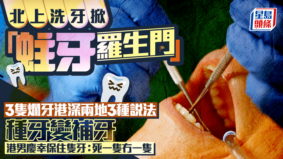 北上洗牙掀「蛀牙羅生門」 3隻蛀牙港深兩地3種說法 種牙變補牙 港男慶幸保住隻牙｜Juicy叮