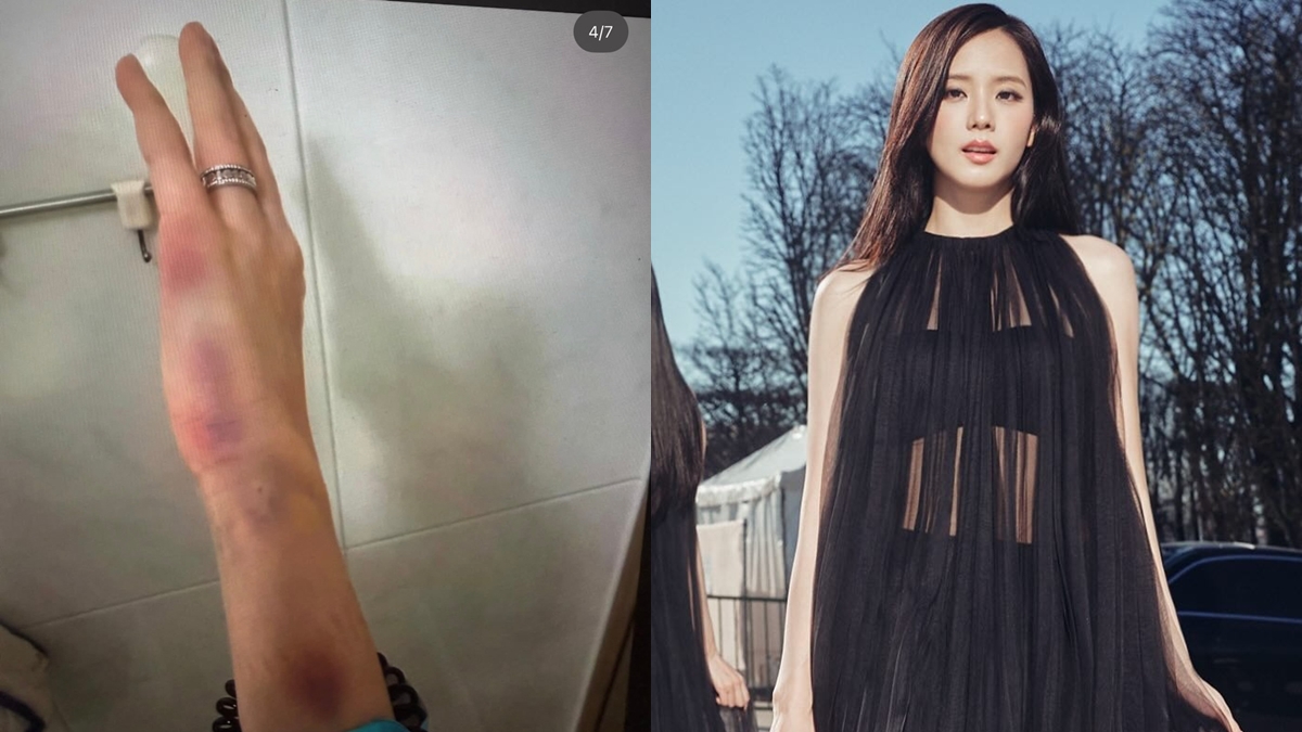 BLACKPINK成員Jisoo胞兄金正勳連環爆醜聞   疑涉性侵被捕網傳家暴太太逼吞穢物拍18禁片