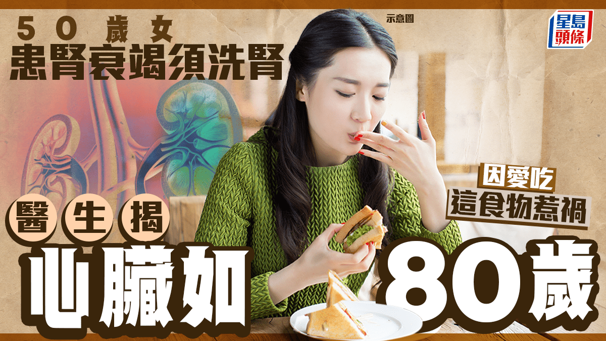50歲女患腎衰竭須洗腎 醫生揭心臟如80歲 因愛吃這食物減壓惹禍 50歲女患腎衰竭須洗腎 醫生揭心臟如80歲 因愛吃這食物減壓惹禍