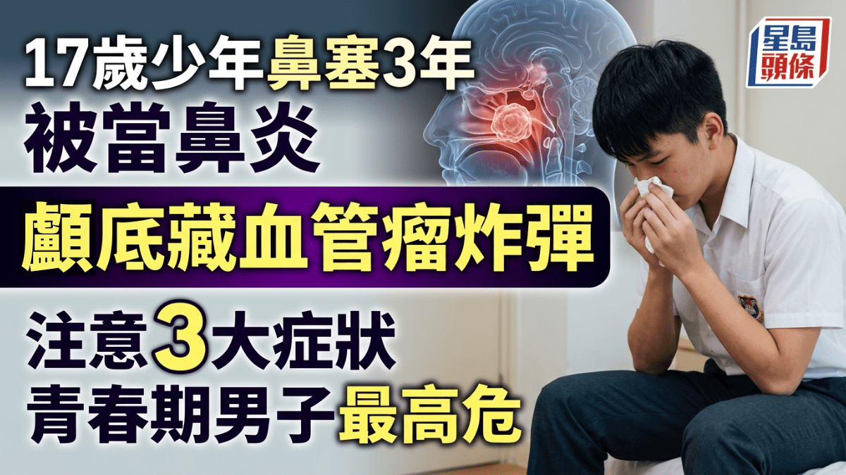 17歲少年鼻塞3年被當鼻炎 顱底竟藏血管瘤炸彈 3症狀持續3個月即求醫青春期男子最高危