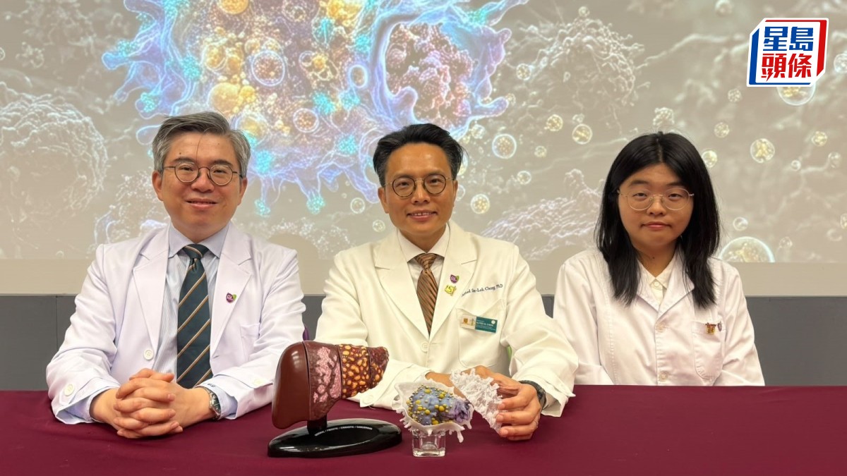 肝癌｜中大醫學院揭使用抑制劑聯同免疫治療  可提高病人存活期兩至三成