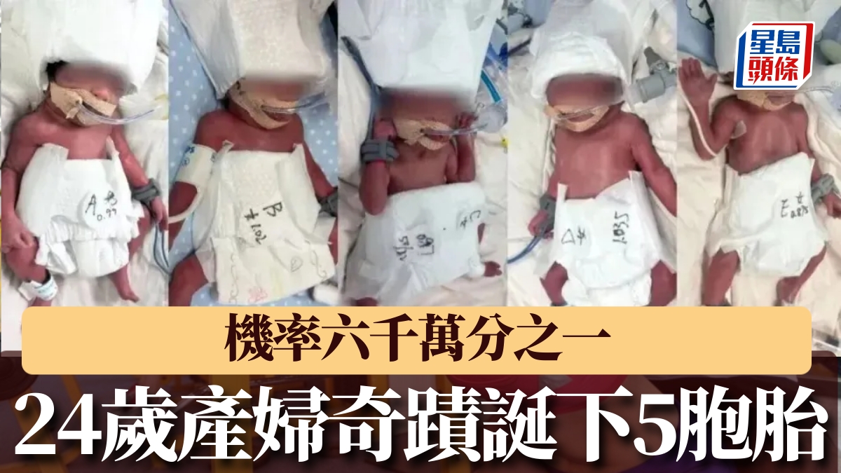 24歲新疆產婦誕5胞胎 機率僅六千萬分之一