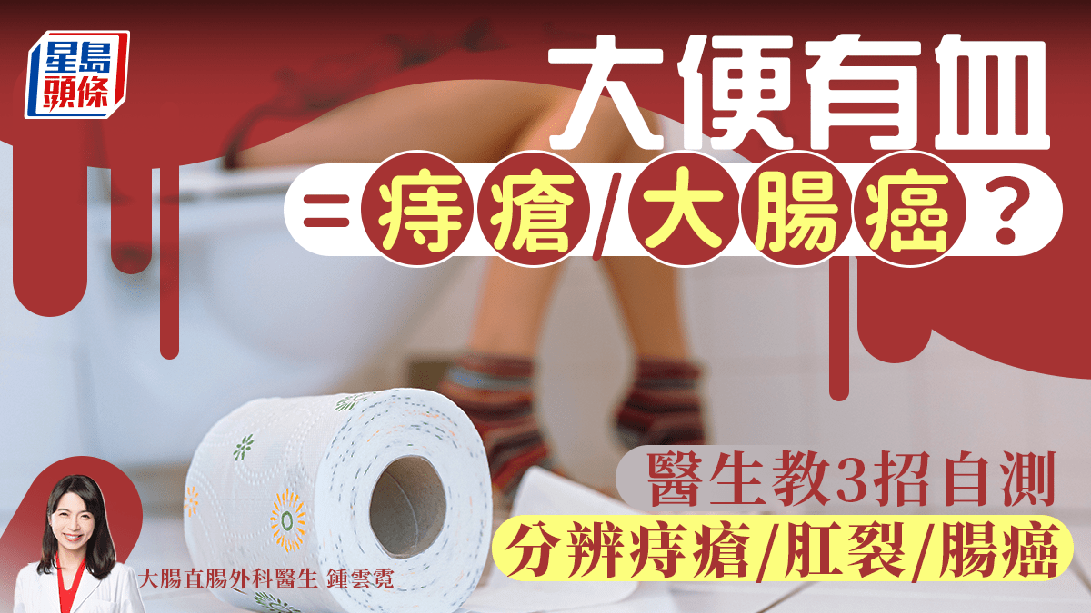 大便有血是痔瘡/肛裂/大腸癌?醫生教3招分辨血便症狀 40歲以上要盡早檢查