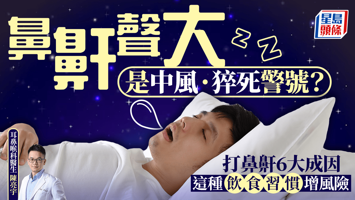 鼻鼾聲大恐是中風/猝死警號?醫生揭打鼻鼾6大成因 這種飲食習慣增風險
