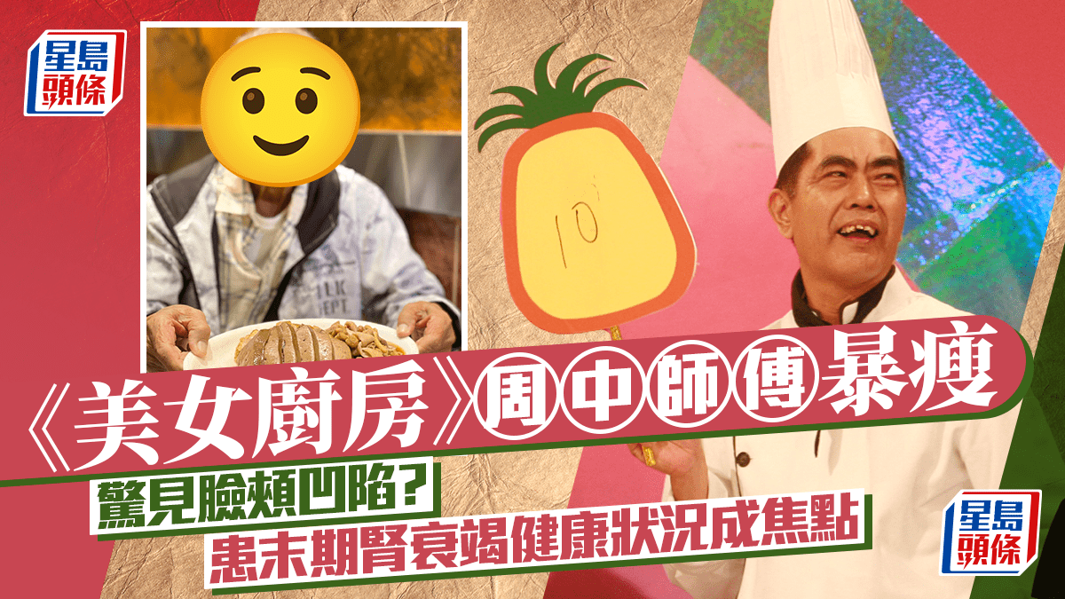 《美女廚房》周中師傅暴瘦近照曝光驚見臉頰凹陷 患末期腎衰竭健康狀況成焦點